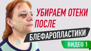 ✅ ТЕЙПИРОВАНИЕПОСЛЕ БЛЕФАРОПЛАСТИКИ | Сания Абдрахманова | Учебный центр BBALANCE