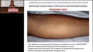 18.02.2017 - Дифференциальный диагноз экзантем у детей