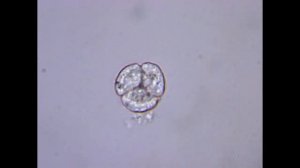 Сразу четыре микроба на свет появились | МИТОЗ - деление, размножение ОДНОКЛЕТОЧНЫХ ПОД МИКРОСКОПОМ