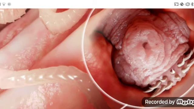 паразиты. 1 Часть. Ленточный червь смотреть онлайн
