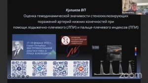 Оценка гемодинамической значимости стено-окклюзирующих поражений артерий нижних конечностей