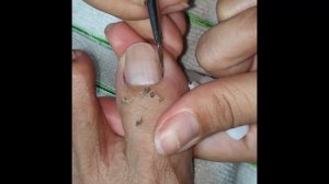 How to Repair Nails easy #201 - Xuyen Nail