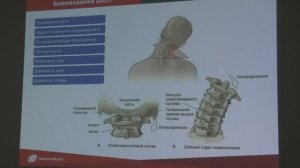 Биомеханика шейного отдела позвоночника. Александр Пилюгин.