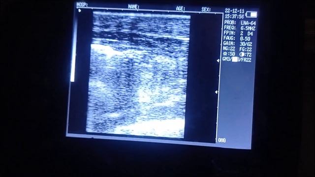 Рыбоводная коммандировка, Челябинск. УЗИ осетрам и получение черной икры смотреть онлайн