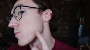 Отрастил БОРОДУ? Что стало после миноксидила? Результат за 6 месяцев.