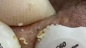 Enjoy Your Day With Hien Nguyen Spa # 1102