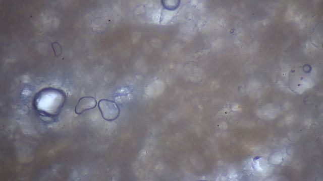 КАК ВЫГЛЯДИТ СОСИСКА ИЗ МАГАЗИНА ПОД МИКРОСКОПОМ смотреть онлайн