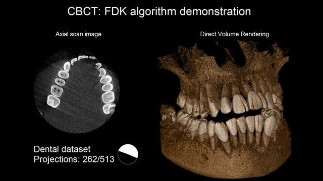 FDK Algorithm Demonstration