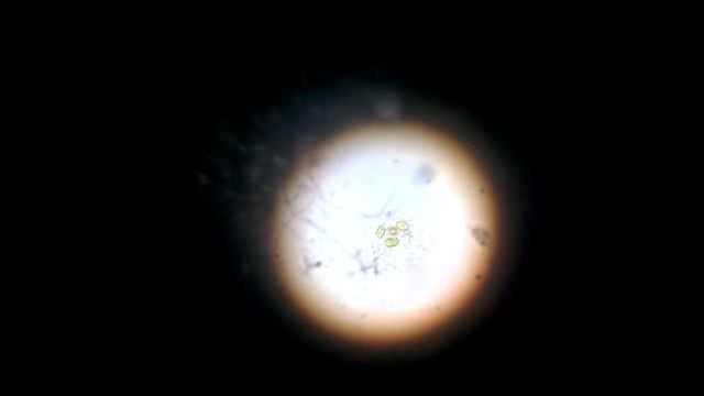 Амёба протей(amoeba proteus) смотреть онлайн