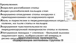 Парез стопы