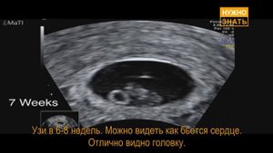 8 неделя беременности. УЗИ в 3D. Что чувствует беременная и этапы развития плода