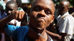 Кто такие Альбиносы?