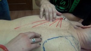 Трапециевидная мышца. Определение границ, мест прикрепления и порций мышцы, направление волокон
