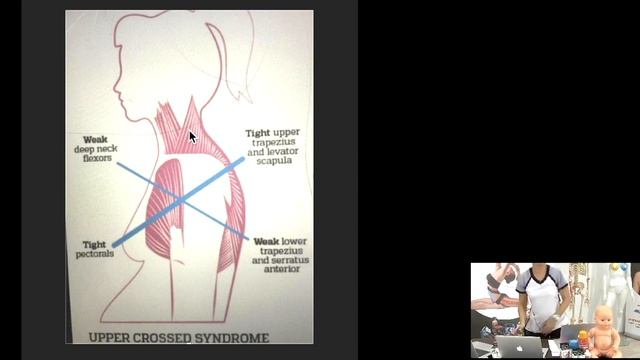 ✅ ЦИФРОВАЯ ИЛИ ГАДЖЕТНАЯ ШЕЯ У ДЕТЕЙ И ПОДРОСТКОВ | Наталья Суворова | Учебный центр BBALANCE смотреть онлайн