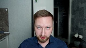 Как я укладываю волосы. Направление роста пересаженных волос. Год и три месяца после пересадки.