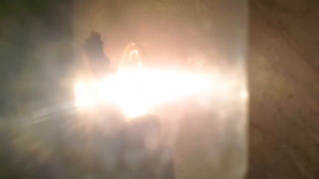 Мышечная дистрофия Эльба - рота . Лечение. Телегомеопатия смотреть онлайн