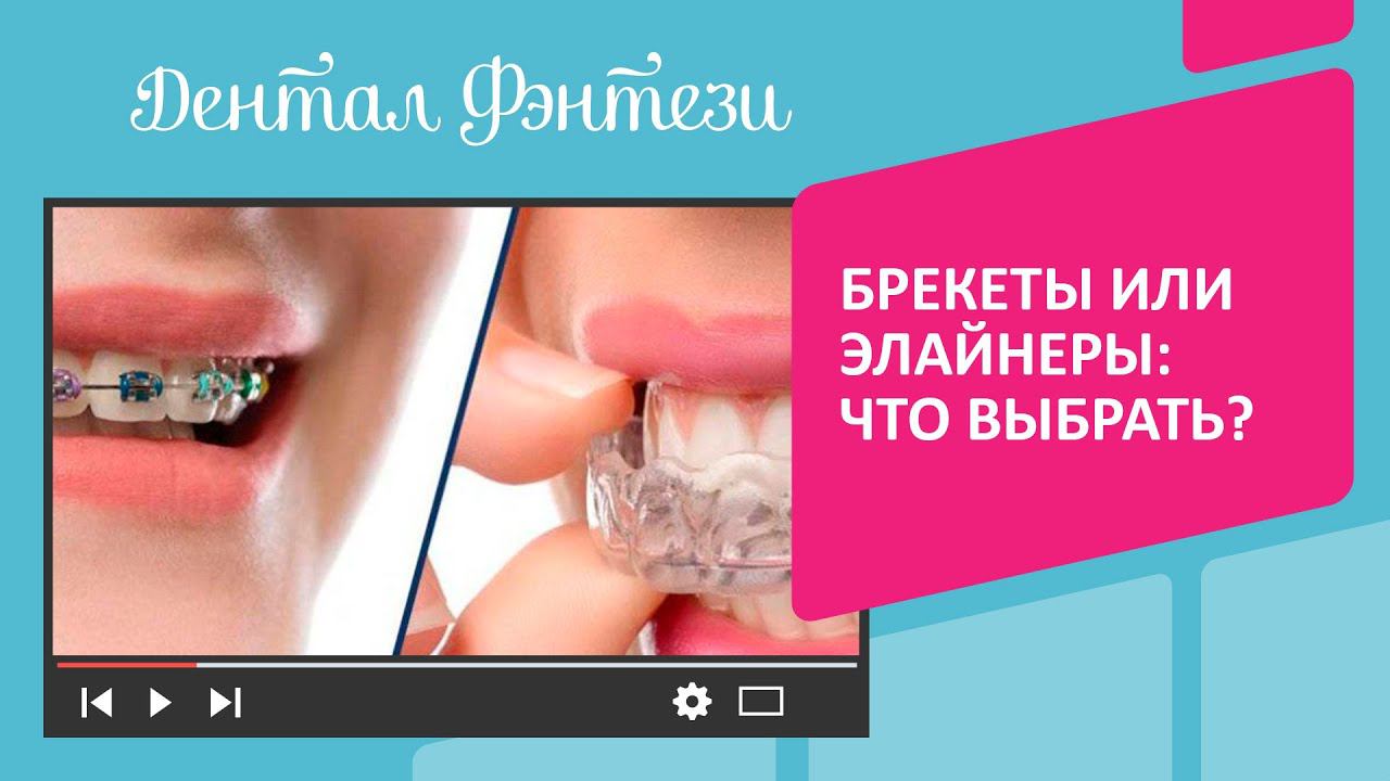 Что лучше детям брекеты или. Элайнеры или брекеты плюсы и минусы. Элайнеры флексилайнер. Каппы FLEXILIGNER