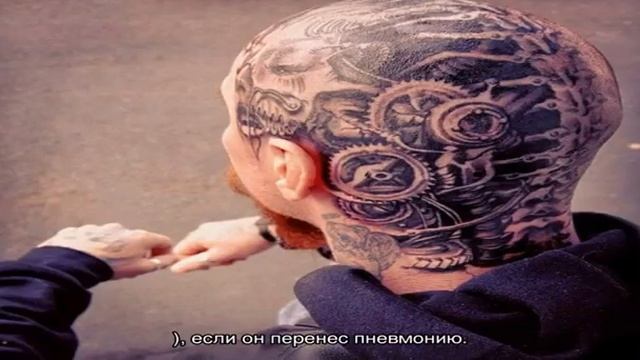 У ребенка 5 месяцев выпадают волосы на голове смотреть онлайн