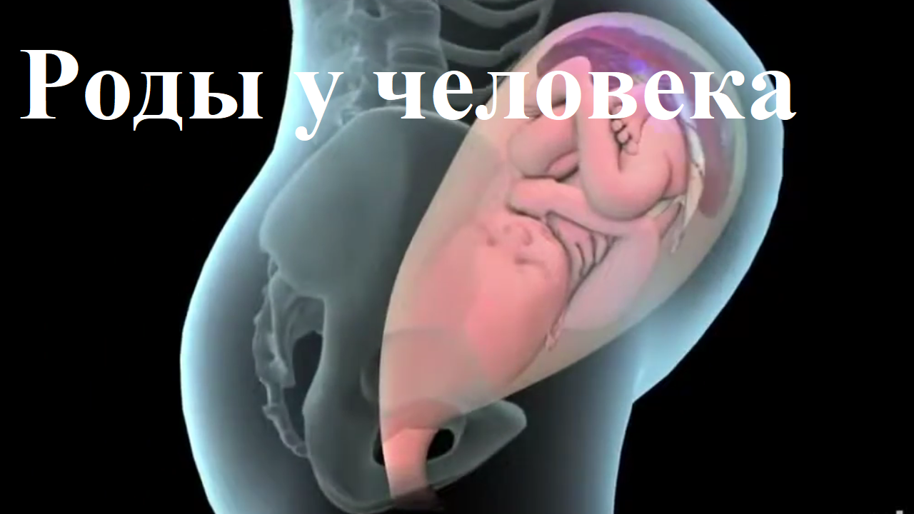 РОДЫ#роды#рожает#родыучеловека