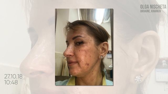 RP РЕВИЗИЯ, ПИЛИНГ смотреть онлайн