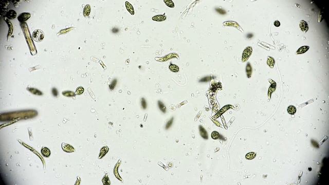 🔬 Amöbe - Wechseltierchen - amoeba limax - microorganism under microscope - Leben im Wassertropfen смотреть онлайн