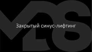 Закрытый синус лифтинг