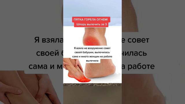 ПЯТКА ГОРЕЛА ОГНЕМ шпору вылечила за 3 дня #народнаямедицина смотреть онлайн