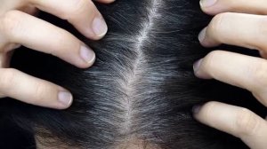 ПОЧЕМУ МЫ СЕДЕЕМ | Как устранить седину волос как избавится от седины