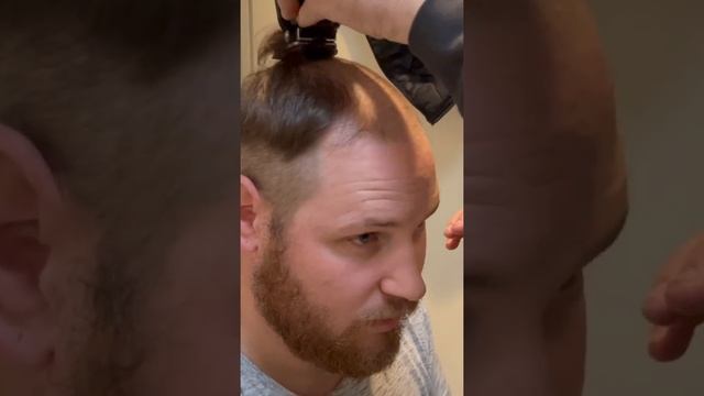 BALDING Man First Time Shaving Head BALD  #shorts