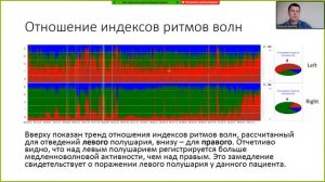Применение трендов ЭЭГ и ПСГ для анализа длительных обследований