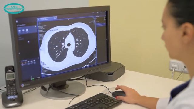 Компьютерная томография смотреть онлайн