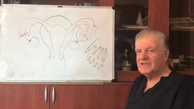 Фимбриолизис (удаление межфимбриалъных спаек маточной трубы). фертилоскопия. смотреть онлайн