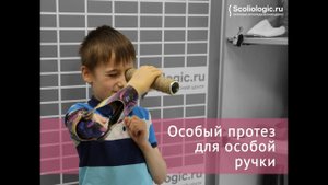 Биоэлектрический протез. чего