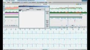Общие настройки анализа по методике Холтер ЭКГ.WMV