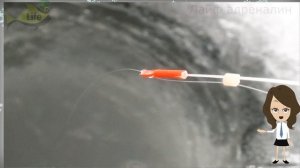 Как ловить карася на мормышку зимой? Секреты ловли мормышкой! Лучшая игра мормышкой на карася зимой