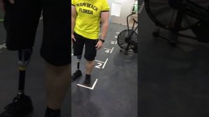 ПЕРВЫЕ ШАГИ НА ПРОТЕЗЕ С ГИДРАВЛИЧЕСКИМ КОЛЕНОМ