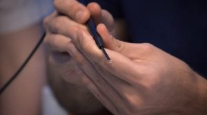 Удаление кожных образований