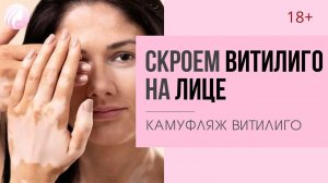 Как СКРЫТЬ пятна ВИТИЛИГО НА ЛИЦЕ? Камуфляж витилиго