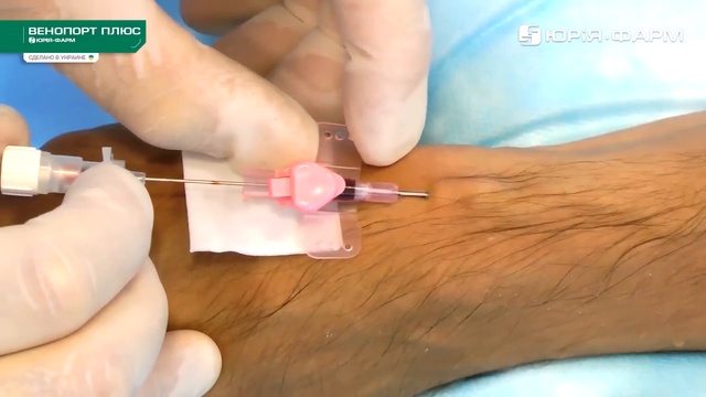 Пункция и катетеризация периферической вены