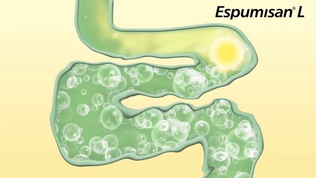 Espumisan L 30.04.2020 смотреть онлайн