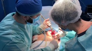 ВАУ эффект Увеличение груди 625 мл | Augmentation mammoplasty | Пластический хирург Ирина Швец