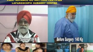 Bariatric Surgery in India : 80 year old canadian gets fresh life after Surgery at Jammu Hospital