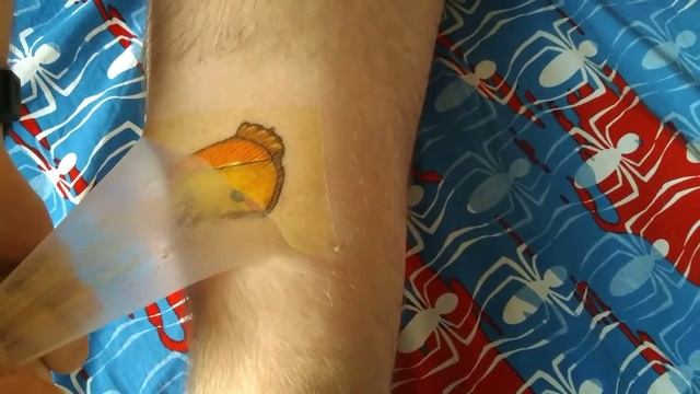 Suprasorb f - как правильно отклеивать? смотреть онлайн