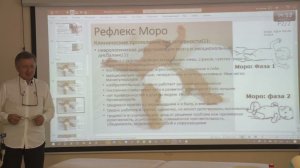 Примитивные Безусловные Рефлексы (рефлексы новорожденных). Преподаватель Колесник М.А.