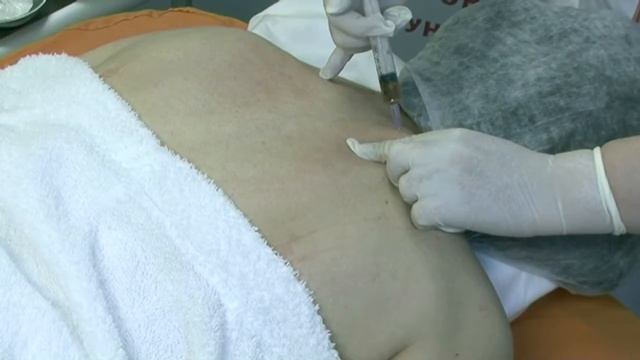 Плацентарная «ЛАЕННЕК терапия» Капельницы молодости   www klinikakda ru