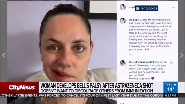 Bell's Palsy from Taking It смотреть онлайн