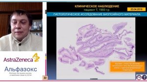 Рак пищевода Баррета у пациента 25 лет: клиническое наблюдение