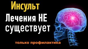 Инсульт лекарства не существует. Профилактика инсульта.