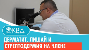 ? Дерматит, лишай и стрептодермия на члене. Клинический случай №501
