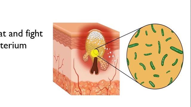 La Roche Posay Effaclar Duo + لاروش بوساي إيفاكلار ديو смотреть онлайн